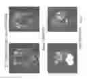 Fig. 04 - Dendritic cell tumor injection (DCTI) therapy