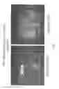 Fig. 05 - Dendritic cell tumor injection (DCTI) therapy