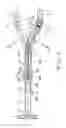 Fig. 04 - Double offset surgical tool handle assembly having a locking linkage aligned along two different planes