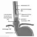 Fig. 01 - DIODE LASER SYSTEMS AND METHODS FOR ENDOSCOPIC TREATMENT OF TISSUE