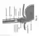Fig. 03 - DIODE LASER SYSTEMS AND METHODS FOR ENDOSCOPIC TREATMENT OF TISSUE