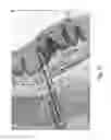 Fig. 06 - DIODE LASER SYSTEMS AND METHODS FOR ENDOSCOPIC TREATMENT OF TISSUE