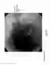 Fig. 07 - DIODE LASER SYSTEMS AND METHODS FOR ENDOSCOPIC TREATMENT OF TISSUE