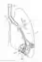 Fig. 01 - CRYOSURGICAL INSTRUMENT