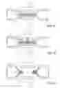 Fig. 04 - Electrosurgical tissue sealing augmented with a seal-enhancing composition