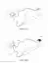 Fig. 40 - Systems for treating a hollow anatomical structure
