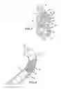 Fig. 04 - MICROFRACTURE AWL