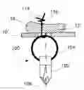 Fig. 01 - Device for anchoring a suture