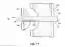 Fig. 13 - FRACTURE MANAGEMENT TOOL AND METHOD