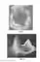Fig. 05 - Patient selectable joint arthroplasty devices and surgical tools