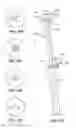 Fig. 22 - Patient selectable joint arthroplasty devices and surgical tools