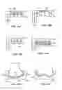 Fig. 32 - Patient selectable joint arthroplasty devices and surgical tools