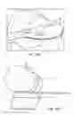 Fig. 38 - Patient selectable joint arthroplasty devices and surgical tools