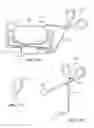 Fig. 40 - Patient selectable joint arthroplasty devices and surgical tools