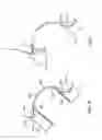 Fig. 44 - Patient selectable joint arthroplasty devices and surgical tools