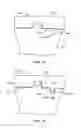 Fig. 46 - Patient selectable joint arthroplasty devices and surgical tools