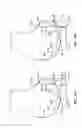 Fig. 47 - Patient selectable joint arthroplasty devices and surgical tools