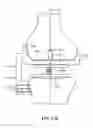 Fig. 51 - Patient selectable joint arthroplasty devices and surgical tools