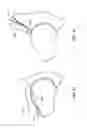 Fig. 54 - Patient selectable joint arthroplasty devices and surgical tools