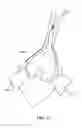 Fig. 56 - Patient selectable joint arthroplasty devices and surgical tools