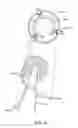 Fig. 57 - Patient selectable joint arthroplasty devices and surgical tools