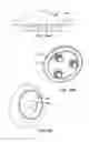 Fig. 62 - Patient selectable joint arthroplasty devices and surgical tools