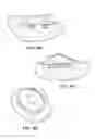 Fig. 63 - Patient selectable joint arthroplasty devices and surgical tools