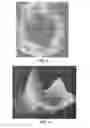 Fig. 05 - Patient selectable joint arthroplasty devices and surgical tools