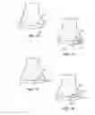 Fig. 07 - Patient selectable joint arthroplasty devices and surgical tools