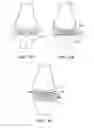 Fig. 13 - Patient selectable joint arthroplasty devices and surgical tools