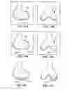 Fig. 16 - Patient selectable joint arthroplasty devices and surgical tools