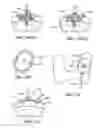 Fig. 18 - Patient selectable joint arthroplasty devices and surgical tools