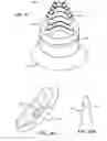 Fig. 20 - Patient selectable joint arthroplasty devices and surgical tools