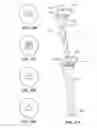 Fig. 22 - Patient selectable joint arthroplasty devices and surgical tools