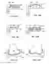 Fig. 32 - Patient selectable joint arthroplasty devices and surgical tools