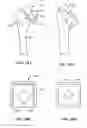 Fig. 41 - Patient selectable joint arthroplasty devices and surgical tools