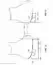 Fig. 45 - Patient selectable joint arthroplasty devices and surgical tools