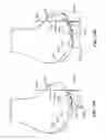 Fig. 48 - Patient selectable joint arthroplasty devices and surgical tools