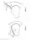 Fig. 54 - Patient selectable joint arthroplasty devices and surgical tools