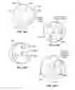 Fig. 59 - Patient selectable joint arthroplasty devices and surgical tools