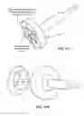 Fig. 61 - Patient selectable joint arthroplasty devices and surgical tools