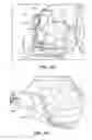 Fig. 36 - PATIENT SELECTABLE JOINT ARTHROPLASTY DEVICES AND SURGICAL TOOLS