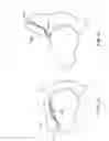 Fig. 54 - PATIENT SELECTABLE JOINT ARTHROPLASTY DEVICES AND SURGICAL TOOLS