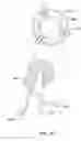 Fig. 57 - PATIENT SELECTABLE JOINT ARTHROPLASTY DEVICES AND SURGICAL TOOLS