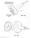 Fig. 61 - PATIENT SELECTABLE JOINT ARTHROPLASTY DEVICES AND SURGICAL TOOLS