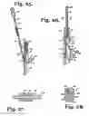 Fig. 09 - Tool system for dynamic spinal implants