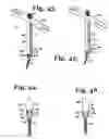 Fig. 13 - Tool system for dynamic spinal implants