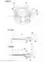 Fig. 04 - Intraocular lens insertion device