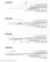 Fig. 20 - Intraocular lens insertion device
