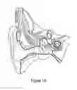 Fig. 02 - Method and apparatus for cochlear implant surgery